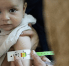 حمایت از ۱۹۳۷ کودک البرزی که سو تغذیه داشتند